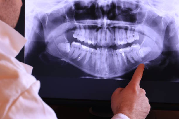 Best Emergency Tooth Extraction in Geneva, AL