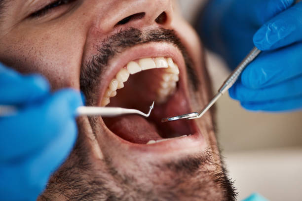 Best Emergency Broken Tooth Repair in Geneva, AL